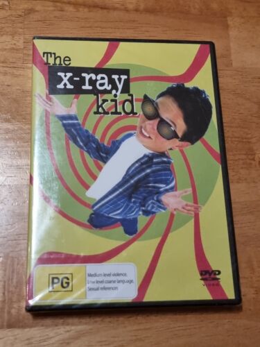 The X-Ray Kid